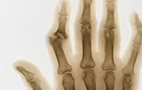 Xray